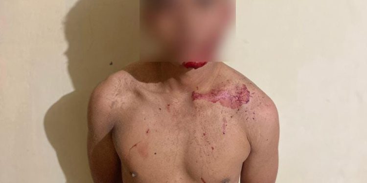 Maling Motor di komplek Pertokoan di Pasar Mulya asri : Pelaku 1 orang ditangkap dan 1 orang DPO