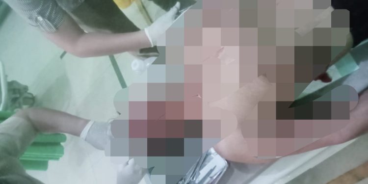 Diduga Masalah Pribadi, Warga Sindangsari di Larikan Kerumah Sakit