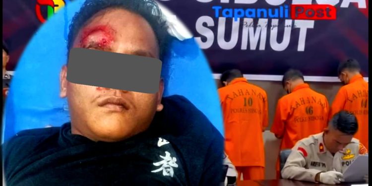 IWOI Simeulue Mengapresiasi Gerak Cepat Kepolisian Menangkap Pelaku Penganiayaan Warga Simeulue di Masjid Agung Sibolga